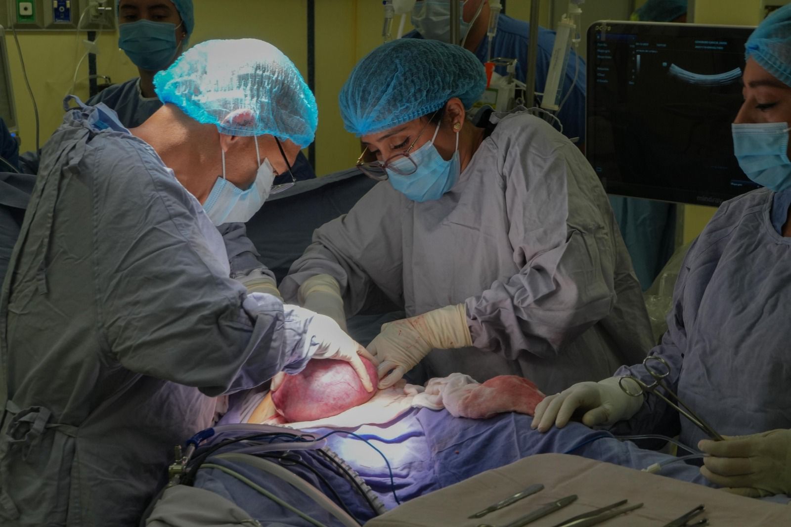 IMSS Bienestar realiza la primera corrección intrauterina de gastrosquisis fetal en México