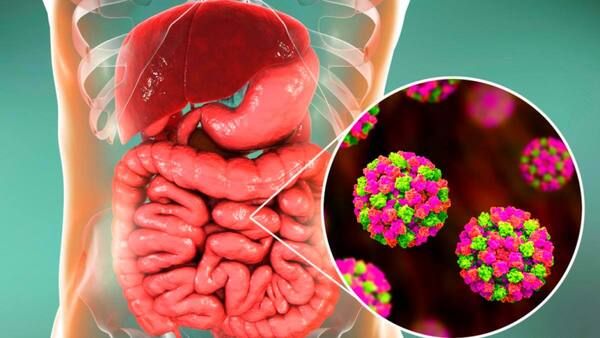 Nueva variante de norovirus dispara alertas sanitarias en Estados Unidos