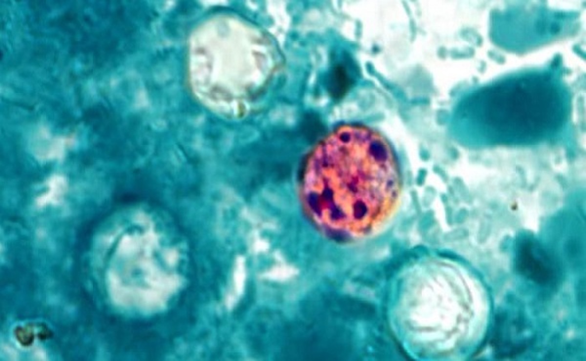 Aumentan casos de ciclosporiasis en EE.UU.; conoce sus síntomas