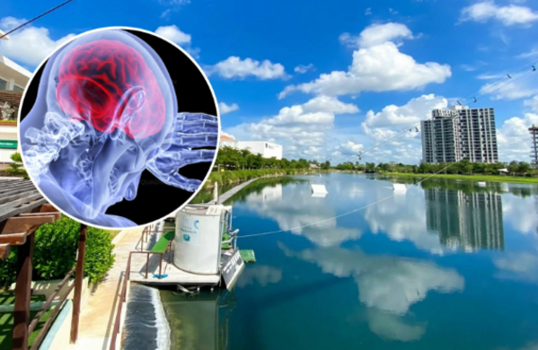 Confirman “ameba comecerebros” en lago artificial de Mérida